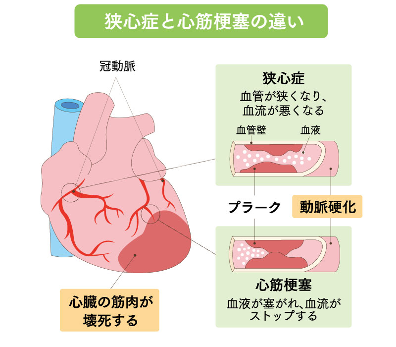 名称未設定-316